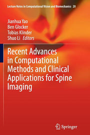 Recent Advances in Computational Methods and Clinical Applications for Spine Imaging (Softcover Reprint of the Original 1st 2015)